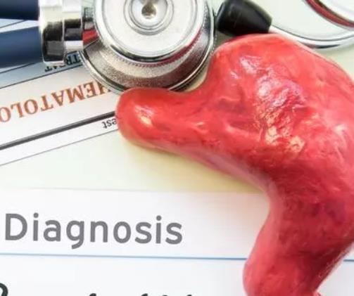 胆汁反流性食管炎症状隐蔽，西医如何治疗？